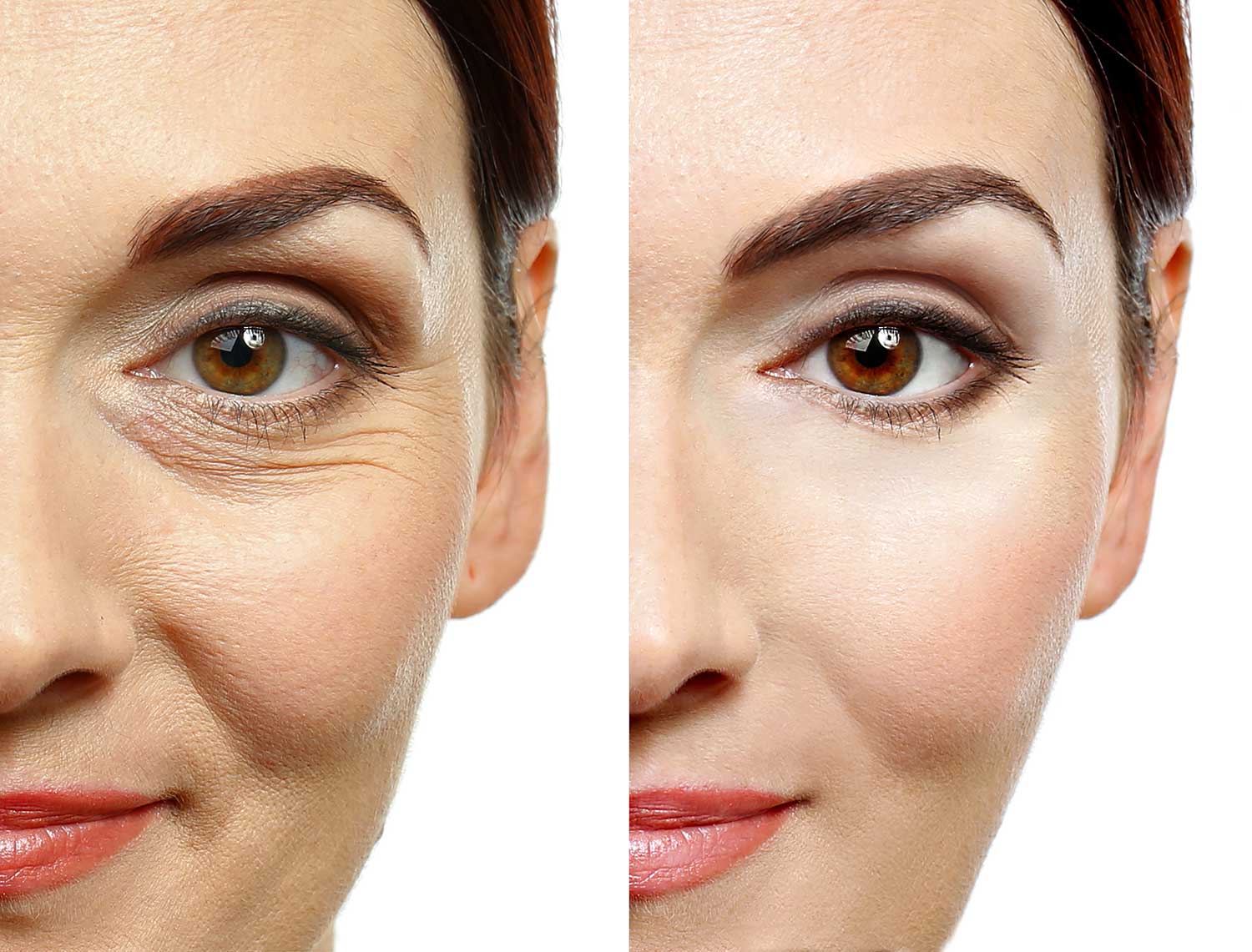 Frequently asked questions about Botox in Colchester